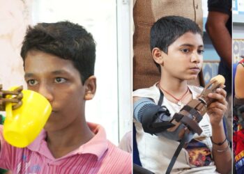 A unique Camp to be held in the city to provide free of cost LN-4 Below Elbow Mechanical Functional Hands for the needy