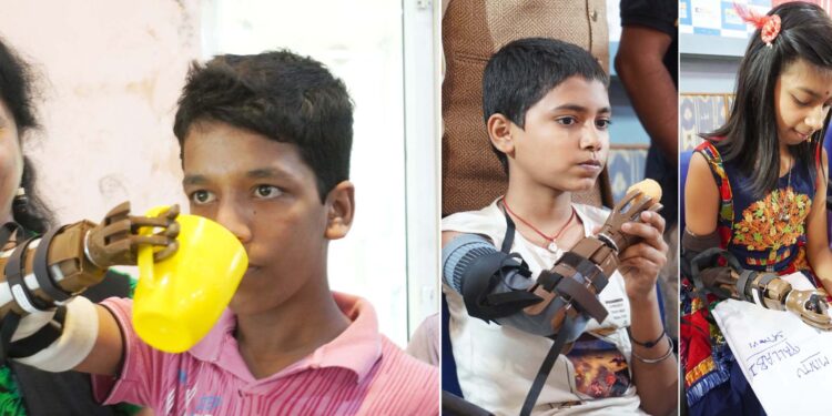 A unique Camp to be held in the city to provide free of cost LN-4 Below Elbow Mechanical Functional Hands for the needy